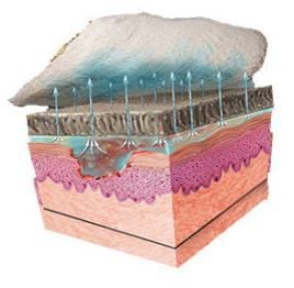 Contact Dressing on Wound