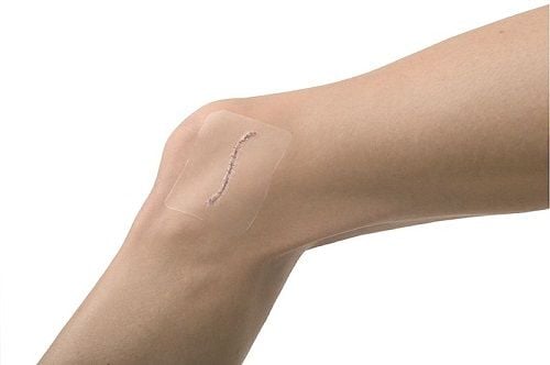 Image 3 of Leukomed T Transparent Film Dressings