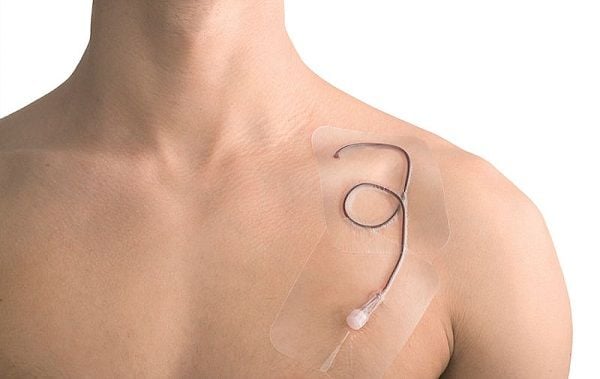 Image 2 of Leukomed T Transparent Film Dressings