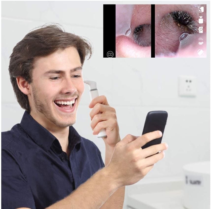 Ear Cleaning Camera Application