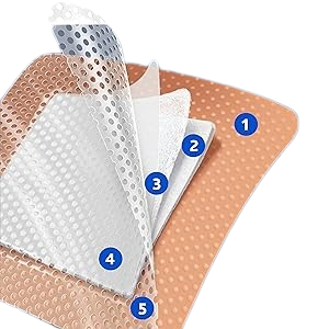 5  Layers of Protection