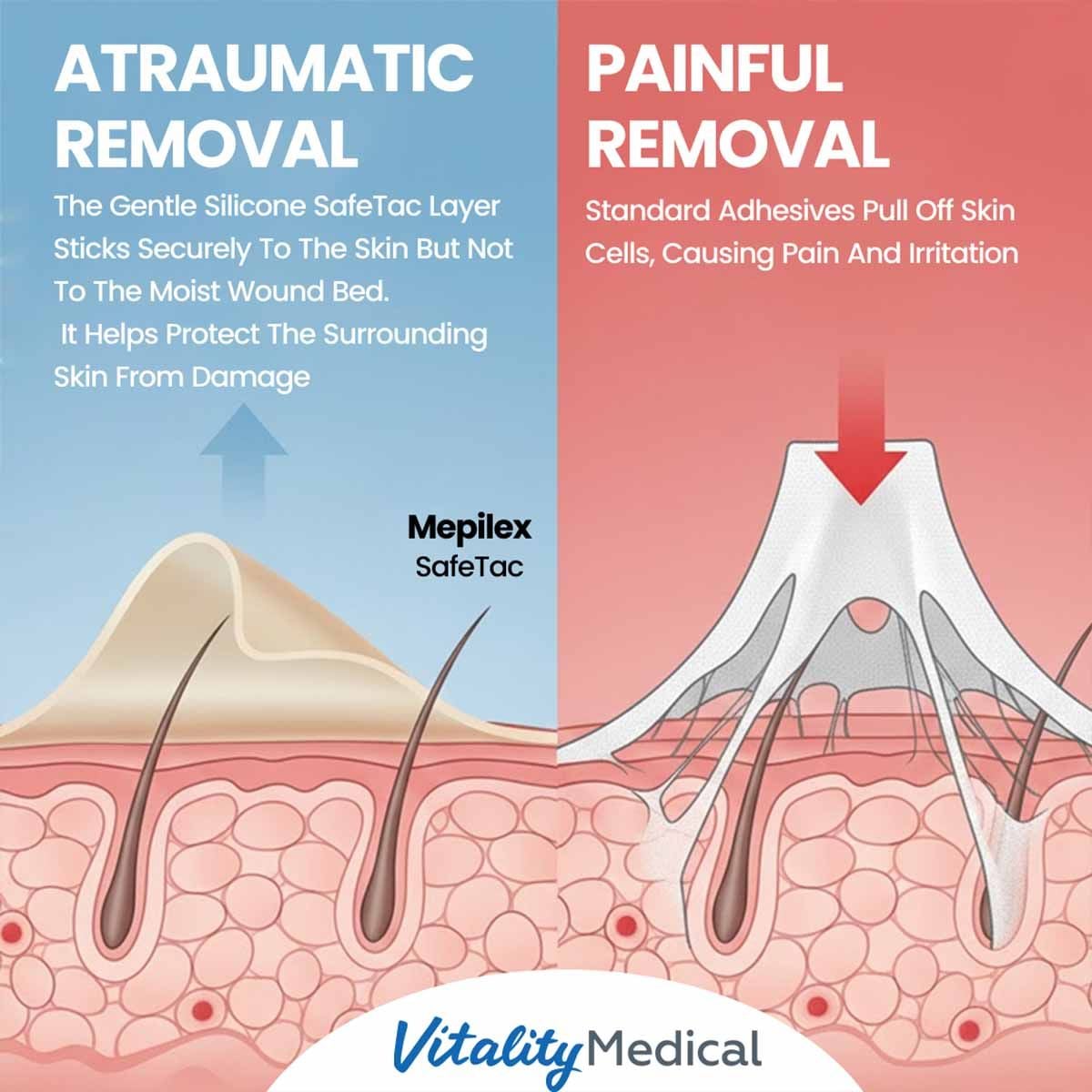 Image 5 of Mepilex Border Flex Foam Dressing for Advanced Wound Care