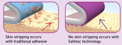 Mepilex Dressing Features