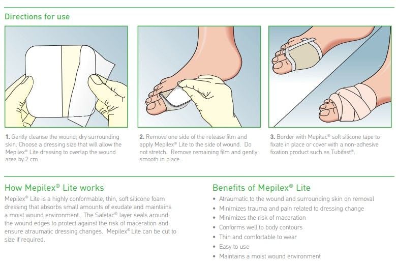 Molnlycke 284190 Mepilex Lite Dressing - 4 x 4 Inches | Vitality