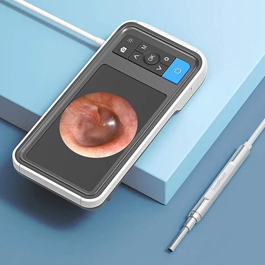 ScopeAround Otoscope - Thumbnail 5
