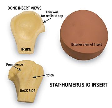 Nasco STAT Humerus intraosseous (IO) Insert