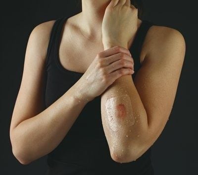 Image 6 of Nexcare Tegaderm Waterproof Transparent Dressing