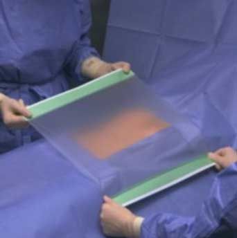 OpSite Incise Drape Transparent Film