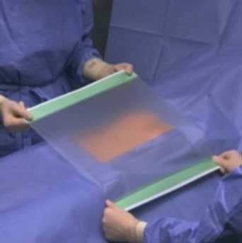 4988 OpSite Incise Drape 11 x 17-3/4 Inch Adhesive Transparent Film