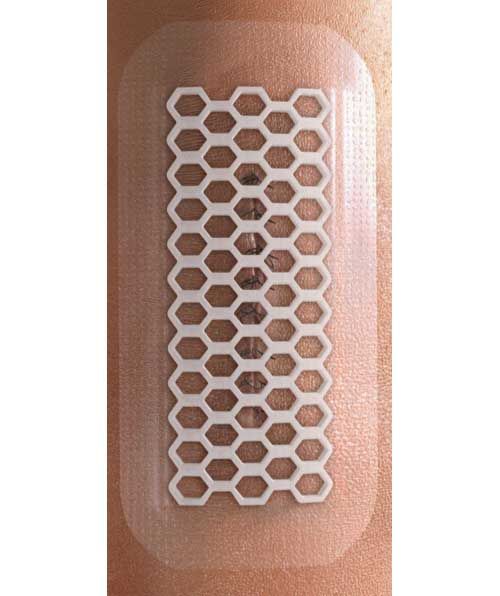 Absorbent Transparent Dressing