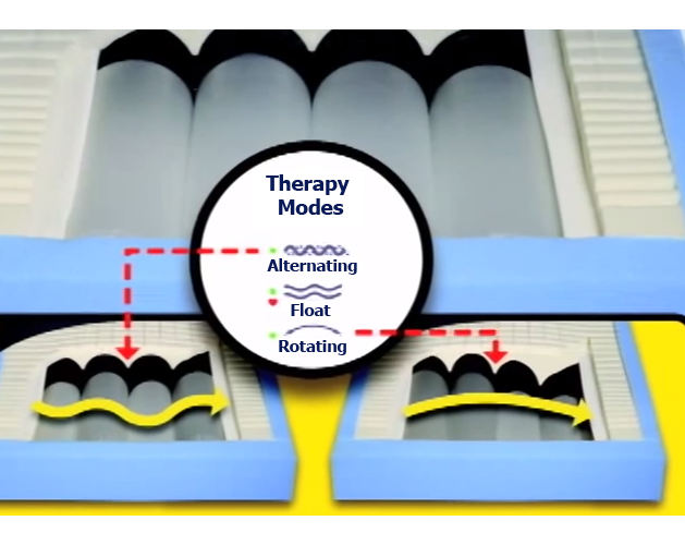 PressureGuard Easy Air XL Therapy Modes