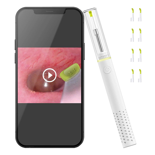 Ear Camera with Cleaning Tips and Smartphone