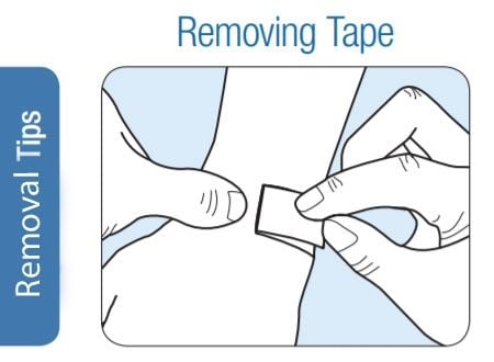 Removing Tape