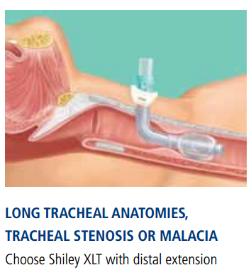 Image 3 of Shiley Tracheostomy Tube XLT Cuffed 