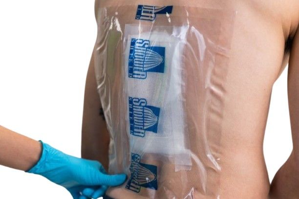 Shower Shield Wound Dressing & Catheter Cover, 10" x 12"