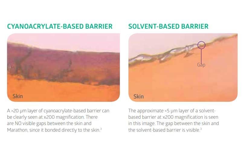 Skin Bonding Comparison Graphic