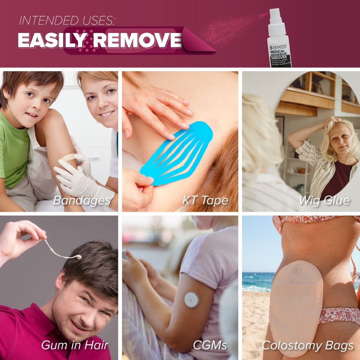 Intended Uses: Easily Remove Bandages, KT Tape, Wig Glue, Gum in Hair, CGMs, and Colostomy Bags