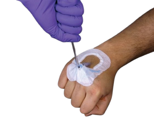 Image 2 of SorbaView Shield - Peripheral, Medium