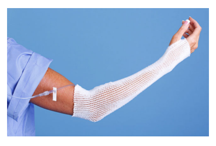Spandage for Arm