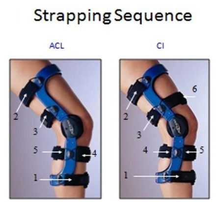 DonJoy FULLFORCE Ligament Knee Brace - ACL & CI | Vitality Medical