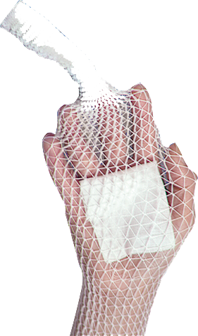 Stretch Net Tubular Elastic Bandage by Deroyal Stretch Net Tubular Elastic Bandage by Deroyal