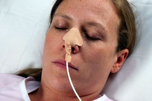 Dale Nasogastric Tube Holder