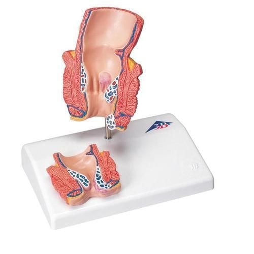 Image 1 of 3B Scientific Hemorrhoid Model