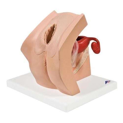 Image 1 of Model for Gynecological Patient Education