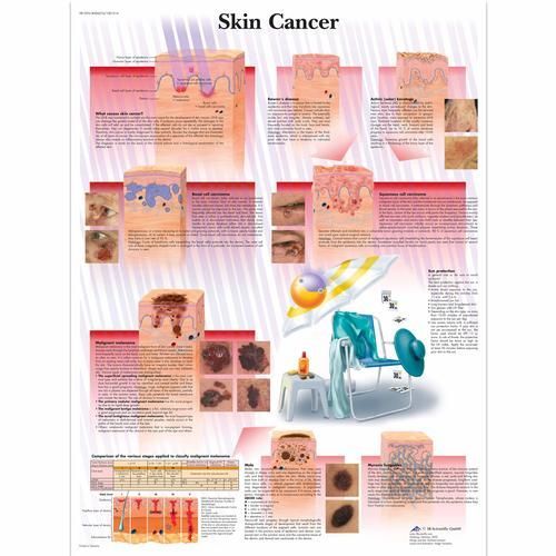 Image 1 of 3B Scientific Skin Cancer Chart