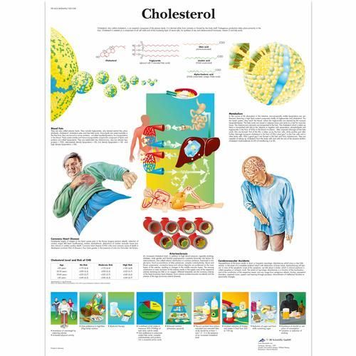 Image 1 of 3B Scientific Cholesterol Chart