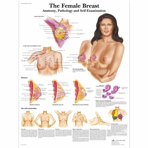 Image 1 of 3B Scientific Female Breast Chart - Anatomy, Pathology and Self-Examination