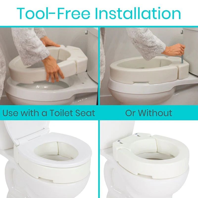 Tool-Free Installation