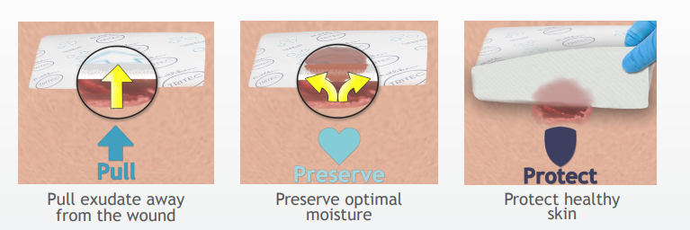 Contact Layer Dressing Features