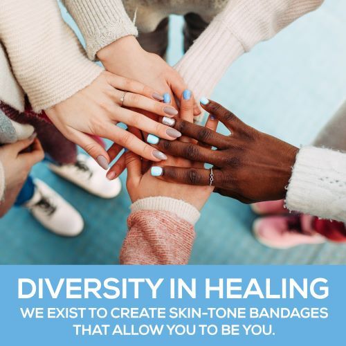 Promotes Diversity