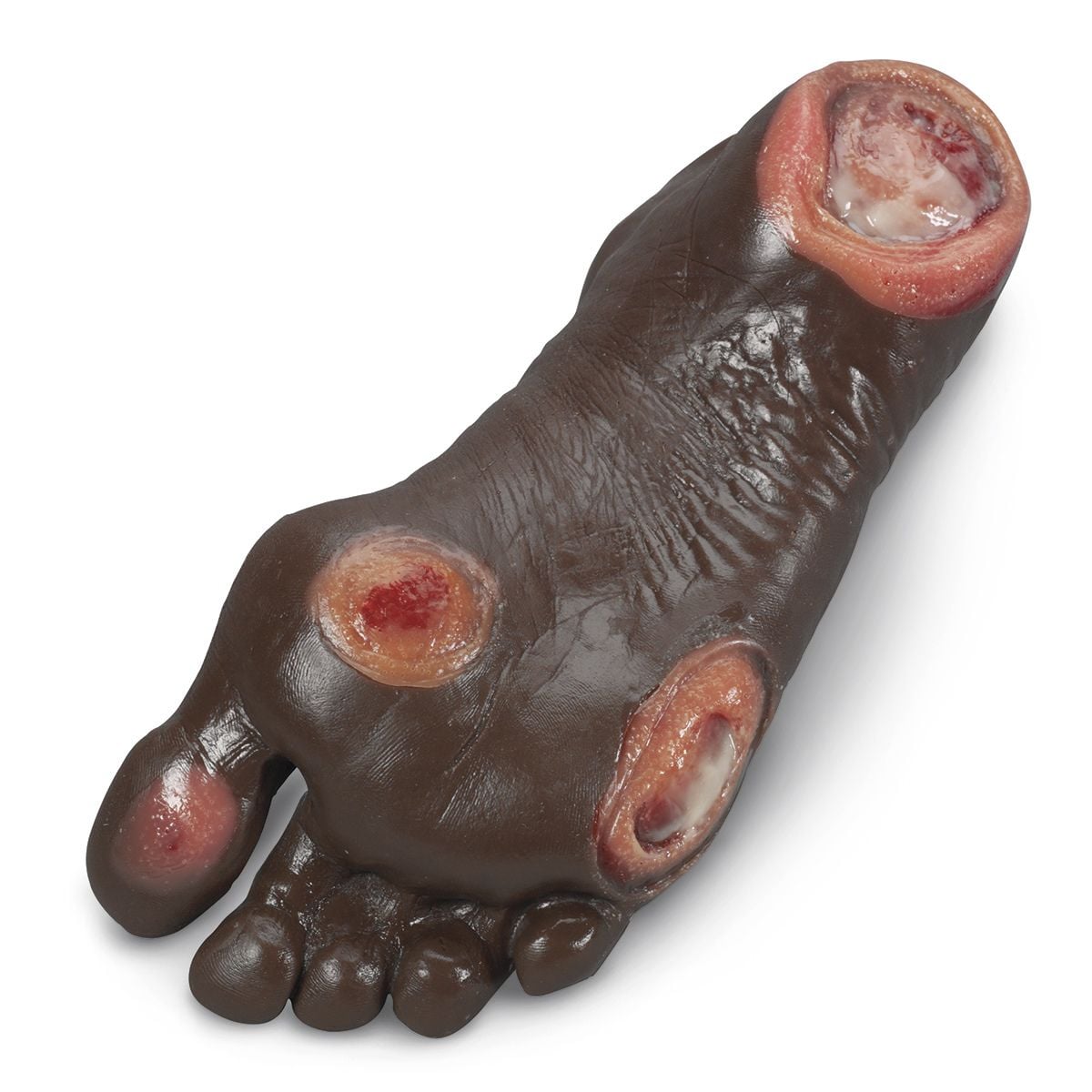 Nasco Life/form Elderly Ulcer Foot