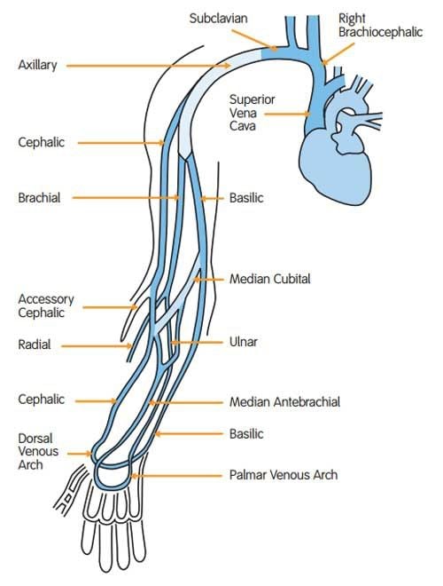 IV3000 Moisture Responsive Catheter Dressings - Peripheral, Central Line,  PICC, or Epidural