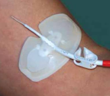 Centurion Wing Guard PICC Sets