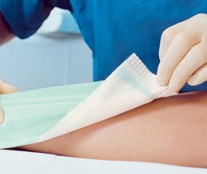 Applying dressing