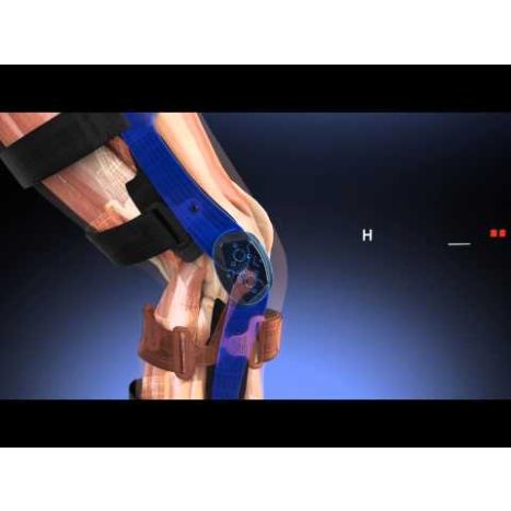 Breg Axiom-D Elite Knee Brace, Aluminum | Vitality Medical