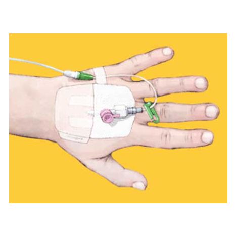 4973 OpSite IV3000 1-Hand 4 x 5-1/2 Inch Dressing BUY