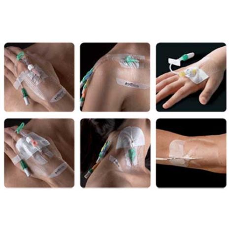 Smith and Nephew 4925 OpSite IV3000 Standard 4 x 5-1/2 Inch