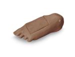 Optional Edema Foot with Deep Tissue Injury