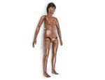 Susie/Simon with Ostomy and Additional Features, Medium