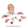 3B Scientific Brain Model - Classic, Neuro, Arteries