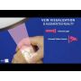 NextVein Handheld Vein Finder System