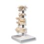 3B Scientific 6 Mounted Vertebrae