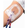 IV Securement