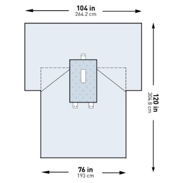 McKesson Abdominal Laparotomy Drape