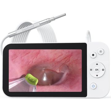 ScopeAround Digital Otoscope With 5 Inch Screen