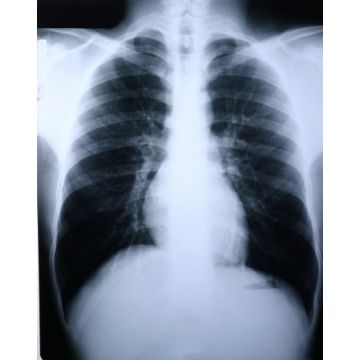 McKesson Clear Choice Performance Medical X-ray Film

